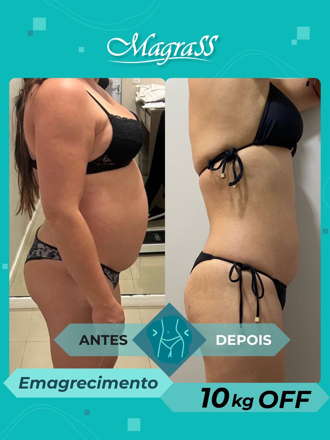 Antes e depois 2